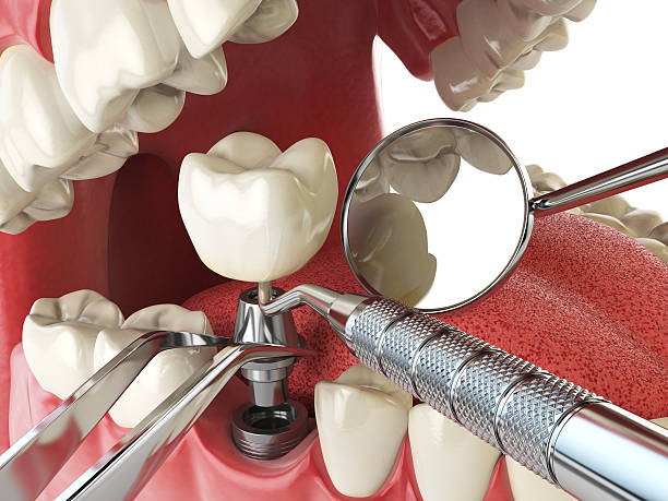 Best Pediatric Emergency Dentist in Cana, VA
