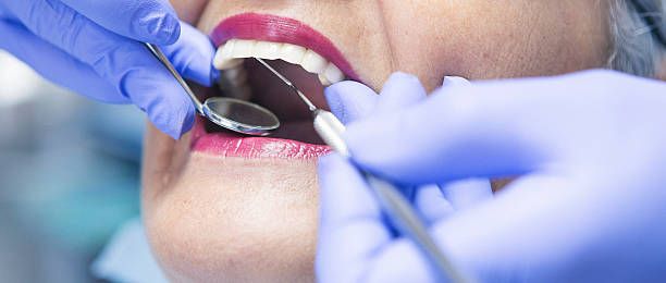 Best Emergency Dental Extractions in Cana, VA